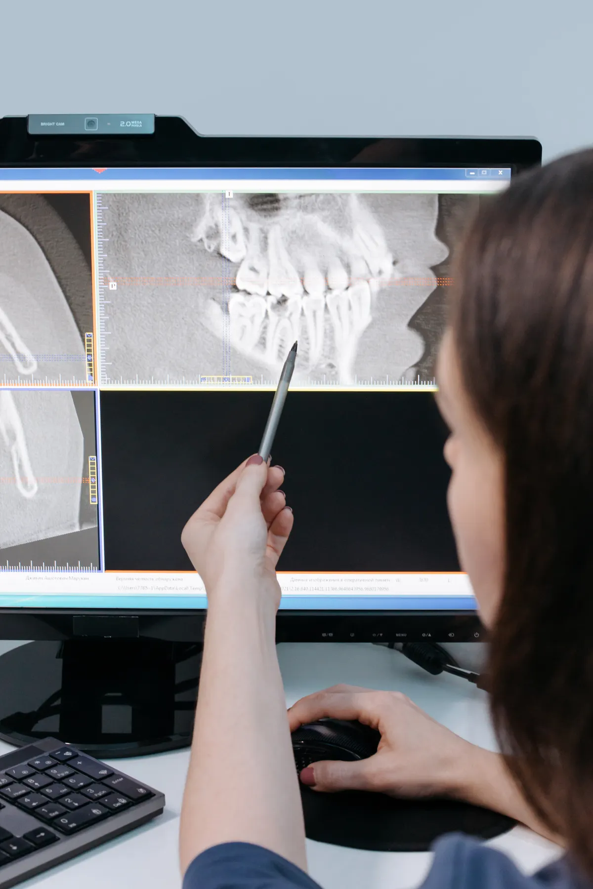 A dentist reviewing a panoramic dental X-ray