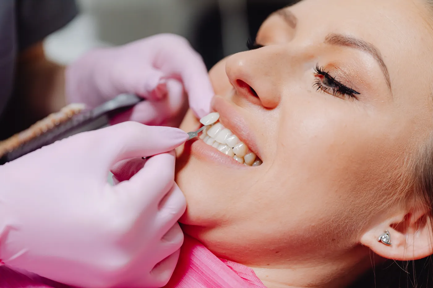 A dentist checking the shade of a patient's teeth